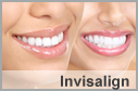 Invisalign Rego Park