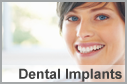 Dental Implants in Rego Park